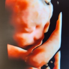 Op. Dr. Özgür Özkul fotoğraf 6