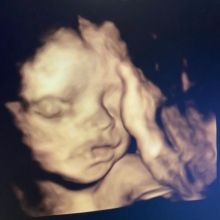 Op. Dr. Emine Suat fotoğraf 3