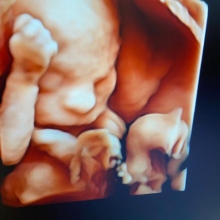 Op. Dr. Emine Suat fotoğraf 6