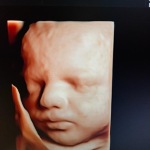 Op. Dr. Özgür Özkul fotoğraf 2