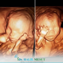 Uzm. Dr. Halil Mesut fotoğraf 2