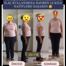 Dyt. Ertan Akpolat fotoğraf 4