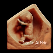 Doç. Dr. Ali Ekiz fotoğraf 8