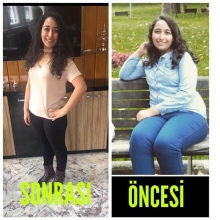Dyt. Ecem Keskinkılıç fotoğraf 7