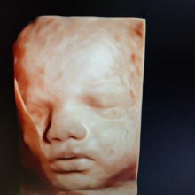 Op. Dr. Özgür Özkul fotoğraf 5