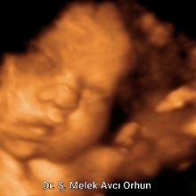Uzm. Dr. Şahver Melek Avcı Orhun fotoğraf 5