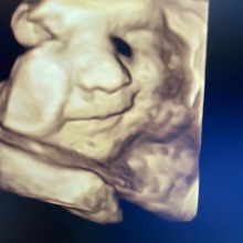 Op. Dr. Emine Suat fotoğraf 5