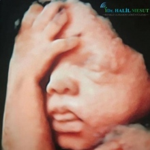 Uzm. Dr. Halil Mesut fotoğraf 1