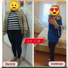 Dyt. Ertan Akpolat fotoğraf 7