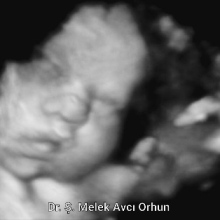 Uzm. Dr. Şahver Melek Avcı Orhun fotoğraf 6