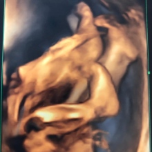 Op. Dr. Nuray Emeklioğlu fotoğraf 6
