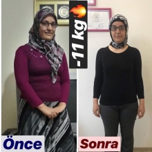 Dyt. Handegül Konu Zorlu fotoğraf 7
