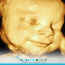 Uzm. Dr. Halil Mesut fotoğraf 3