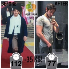 Dyt. Anıl Kaya fotoğraf 3