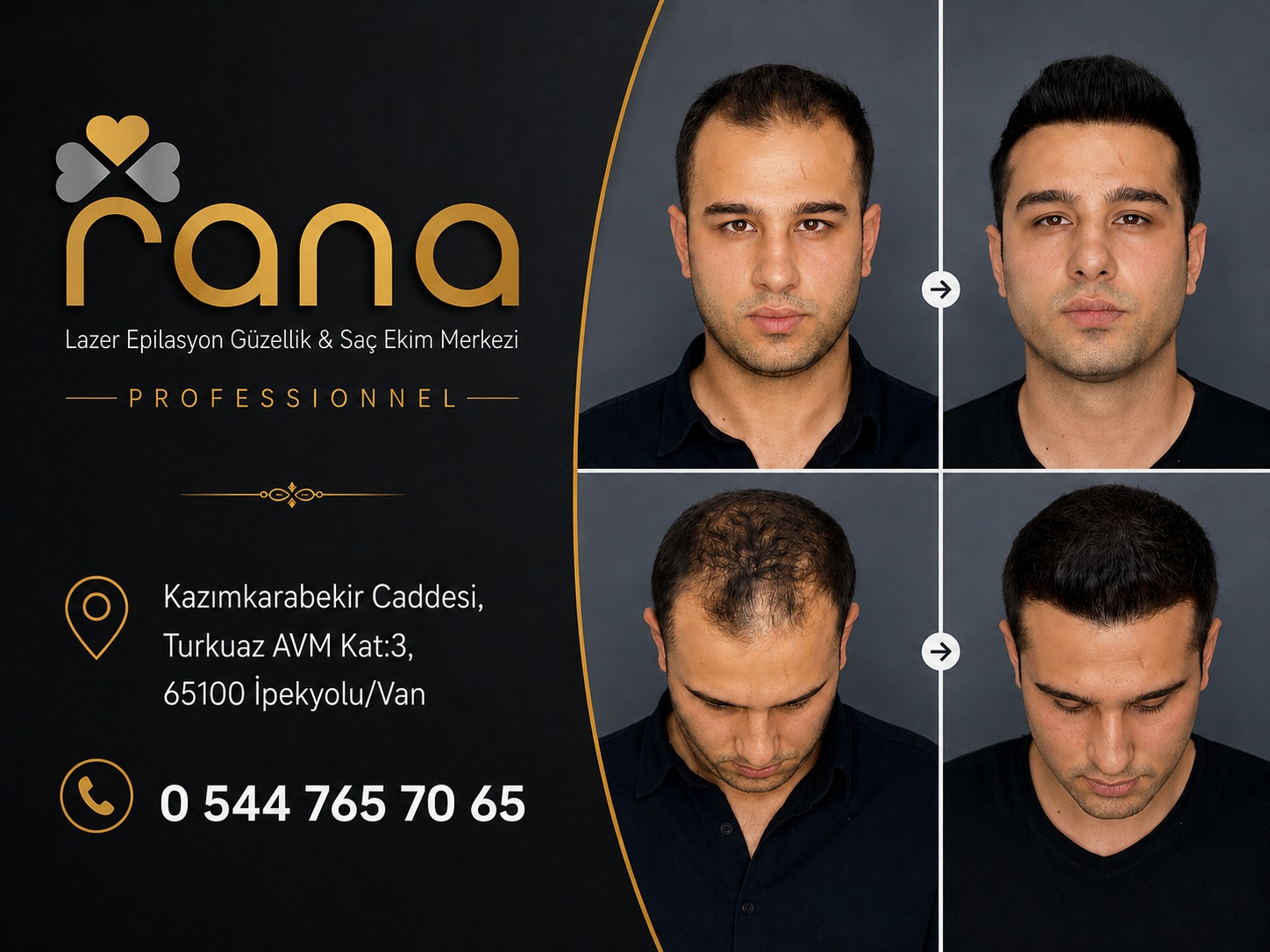 Van Rana Güzellik Merkezi fotoğraf 2